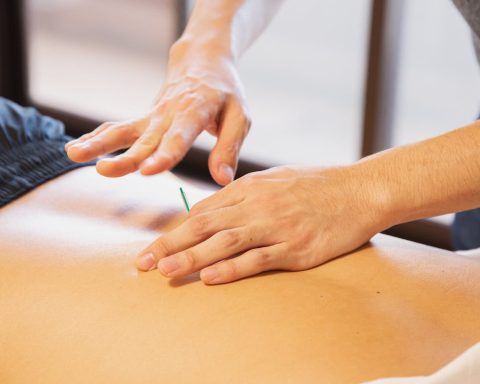 Dry needling: ontdek de voordelen voor vrouwen