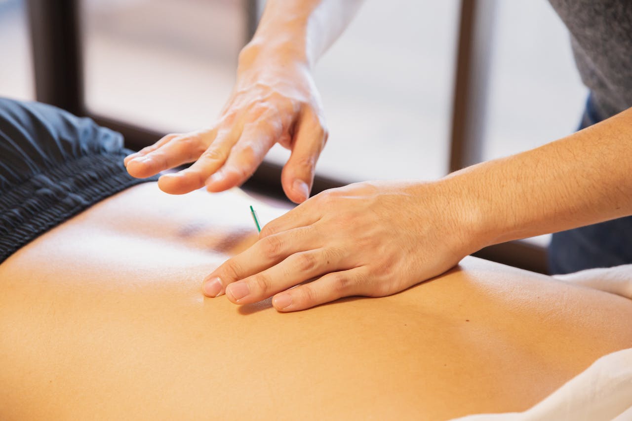 Dry needling: ontdek de voordelen voor vrouwen